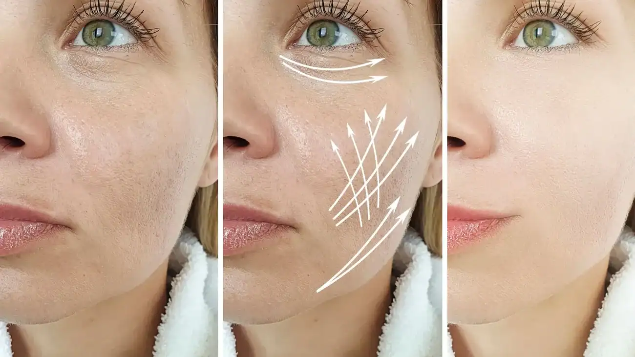 Can One Treatment Really Tackle More Than One Skin Concern Romford?