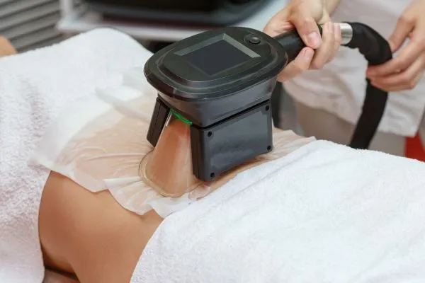 Image of person having fat freezing treatment to help weight gain Romford