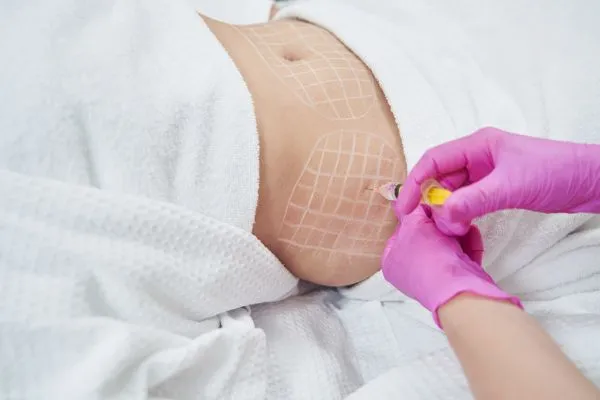 image of fat dissolving injections on love handles to help combat weight gain Romford