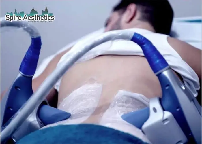 Man having fat freezing treatment done on love handles before a competitions Romford to create a sculpted look.