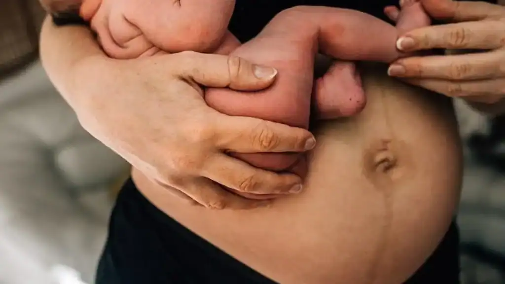 Why Is My Stomach Still Big After Pregnancy Romford?
